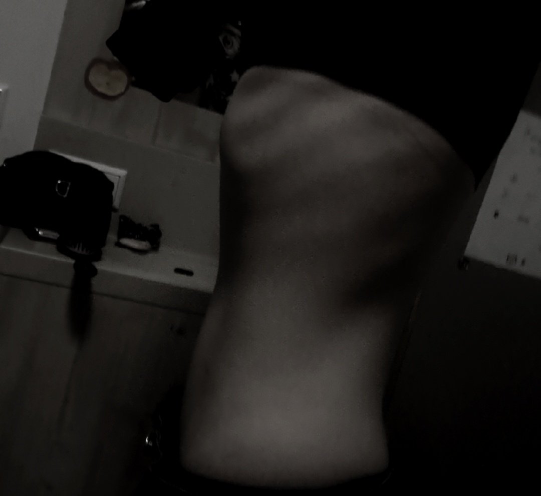 𐔌 ᛝ 𝓥alentin .ᐟ 🖤 inpatient/recov tweet media