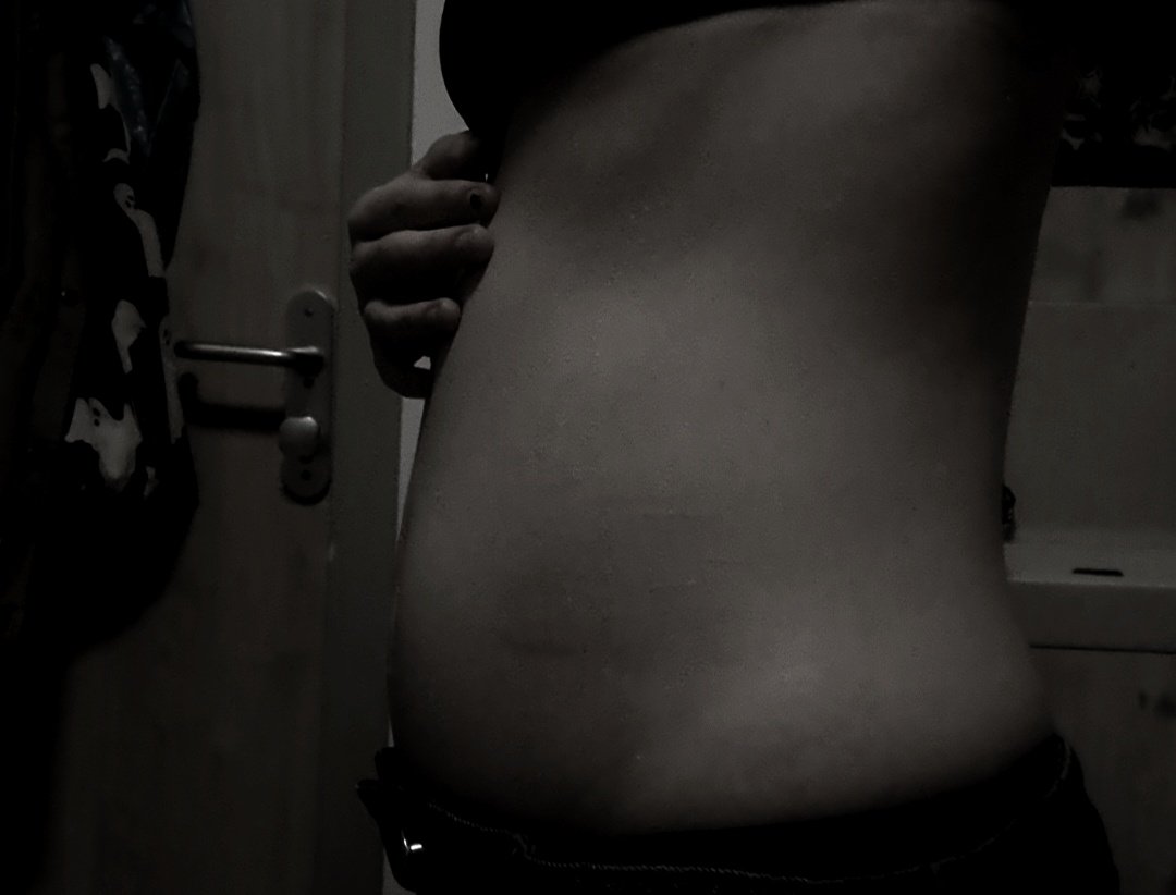 𐔌 ᛝ 𝓥alentin .ᐟ 🖤 inpatient/recov tweet media