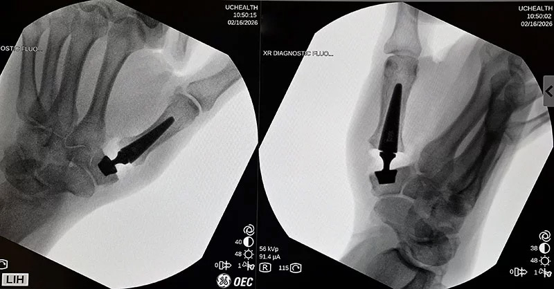CU Anschutz School of Medicine tweet media