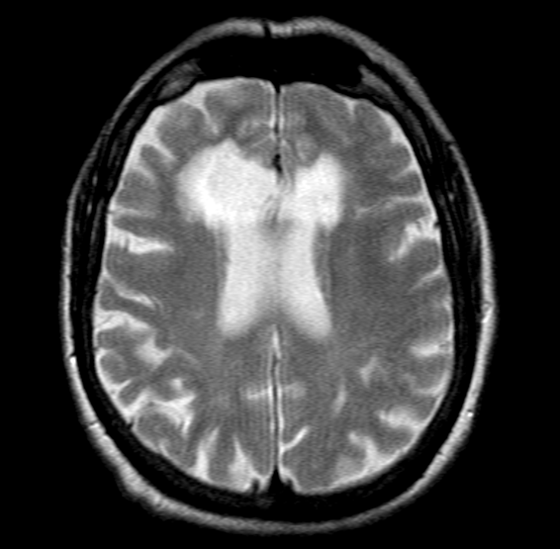 Jack Garnham tweet media