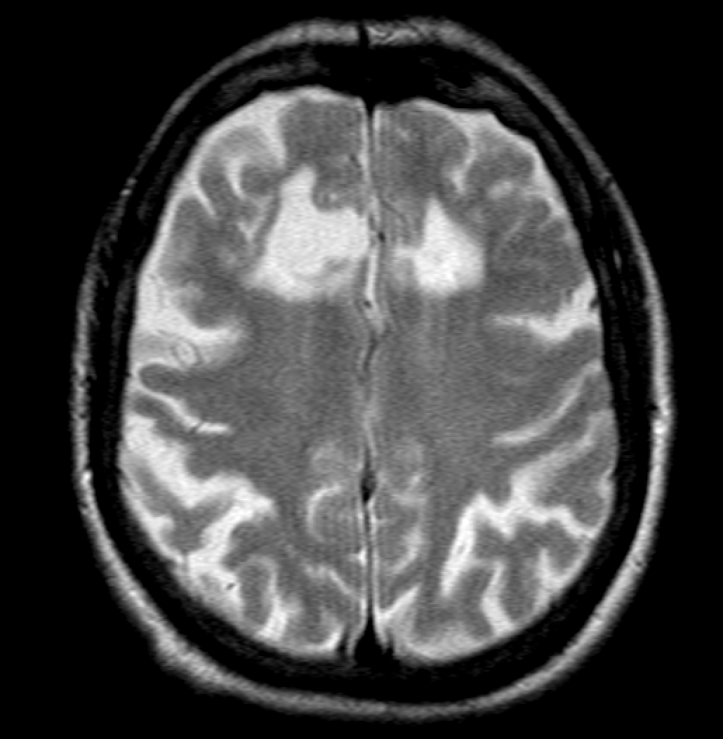 Jack Garnham tweet media