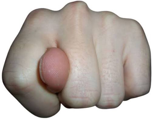 Bunu kutlarsın mikrop