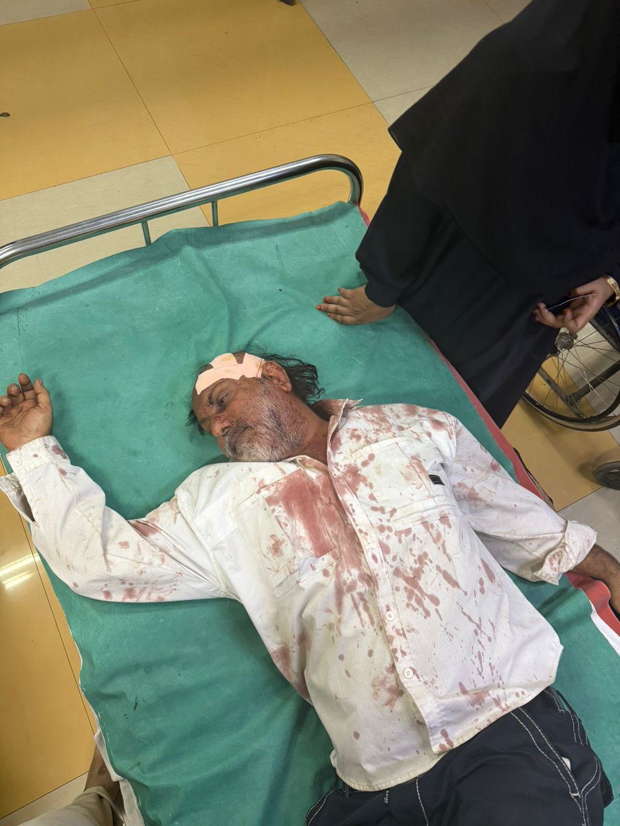 Amrut Nagar shocker: Ayub (alleged Goregaon police informer), his brother Ibrahim &amp; associates assaulted 15-yr-old Moin and friend Saad. Saad’s father was beaten too.Accused allegedly claim police backing. Demand fair probe &amp; justice. <a href="/GoregaonPS/">गोरेगाव पोलीस ठाणे - Goregaon PS Mumbai</a> <a href="/DcpZone11Mumbai/">पोलीस उप आयुक्त परिमंडळ ११ - DCP ZONE 11 Mumbai</a> <a href="/CMOMaharashtra/">CMO Maharashtra</a>