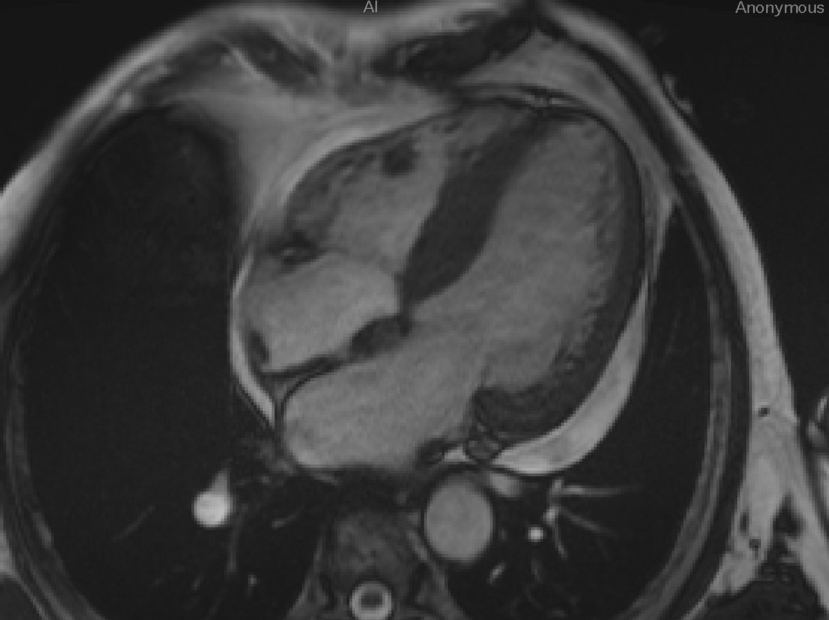 Federico Marchini tweet media