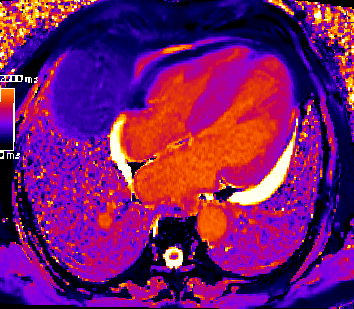 Federico Marchini tweet media