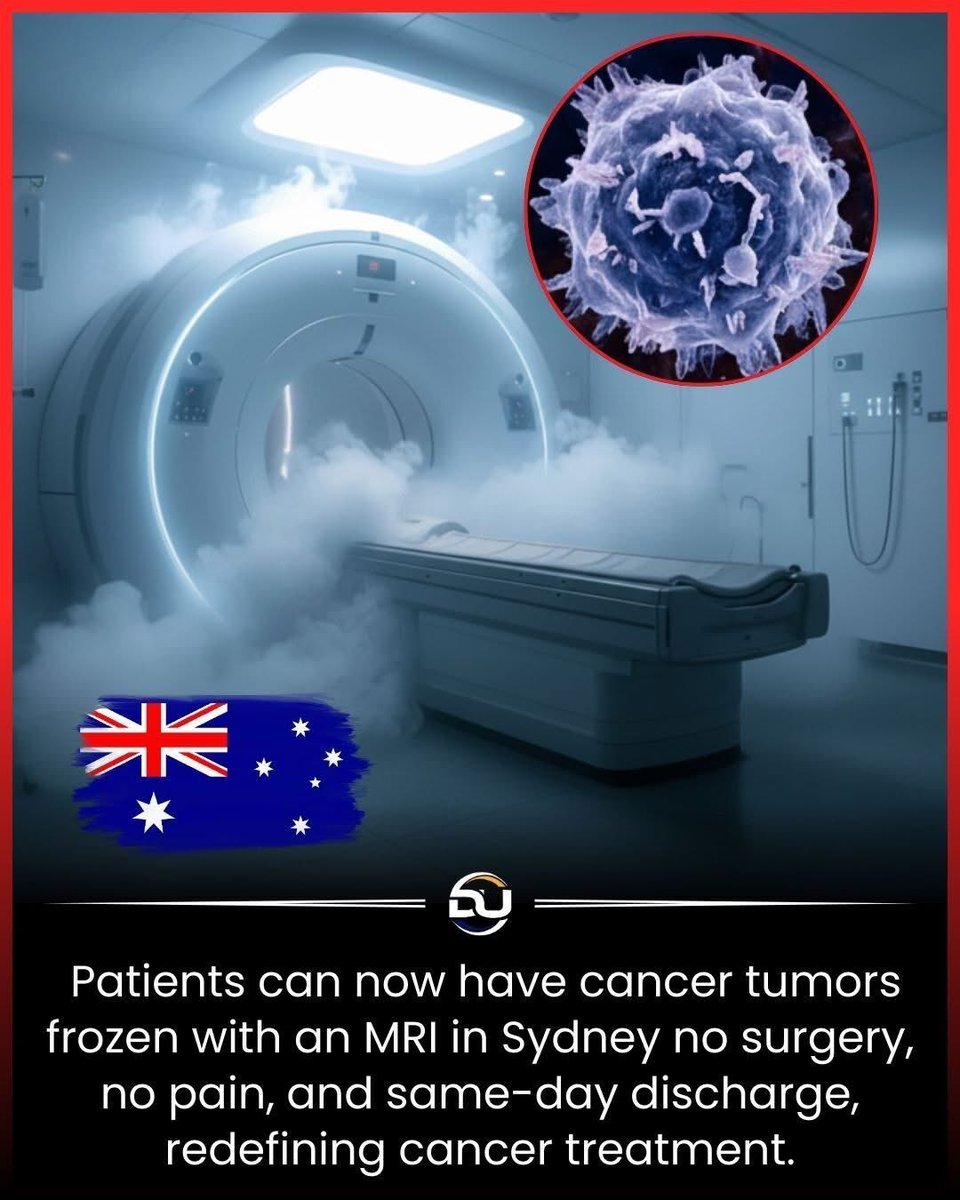 Revolutionary MRI freezes cancer tumors painlessly without surgery

A groundbreaking cancer treatment in Sydney is transforming how we fight one of humanity’s deadliest diseases. 

Unlike traditional surgery or radiation, this new procedure uses advanced MRI technology to target