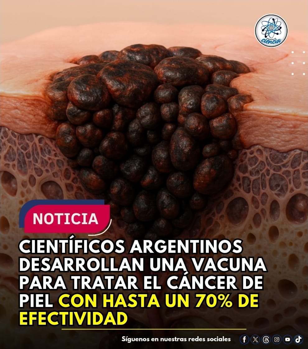 La vacuna lleva por nombre VACCIMEL 

Y se reporta que la vacuna alcanza una eficacia de cerca del 70%. Este porcentaje supera por mucho al del tratamiento estándar. Además, si se toma en cuenta que hay entre 1200 y 1500 casos al año de melanoma cutáneo (tan solo en Argentina) y