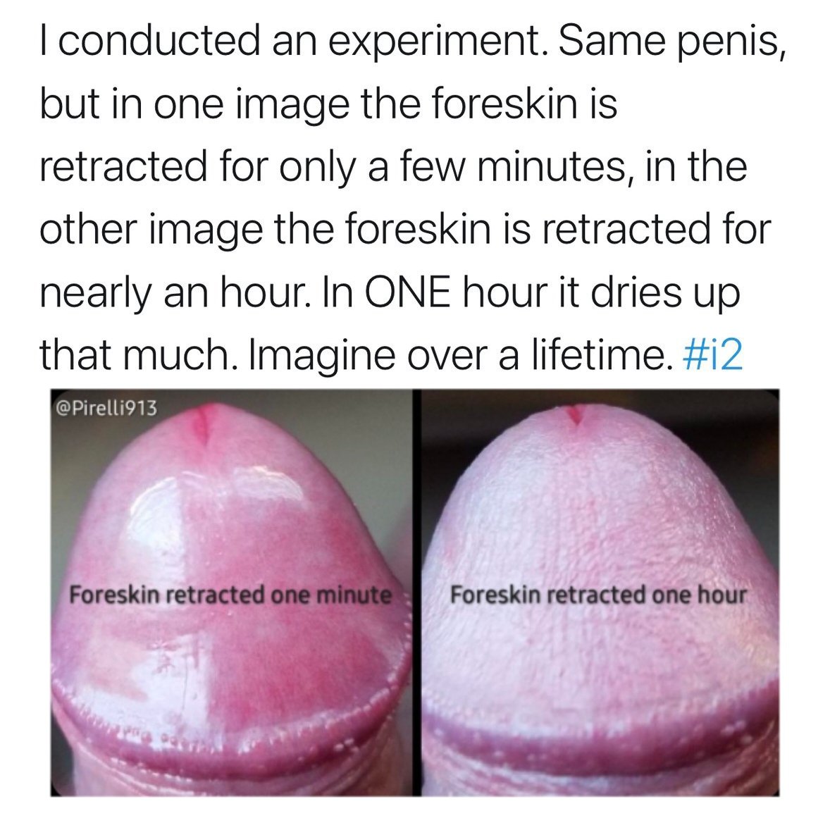 5ugger (foreskin) tweet media