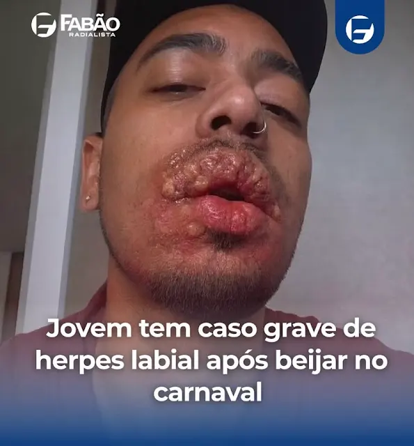 onlythegold's tweet photo. Vocês aí depois de várias barracas do beijo, vai lá pegador tudo que vem fácil vai fácil kkkkkkkkk https://t.co/rlSCAqKyP3