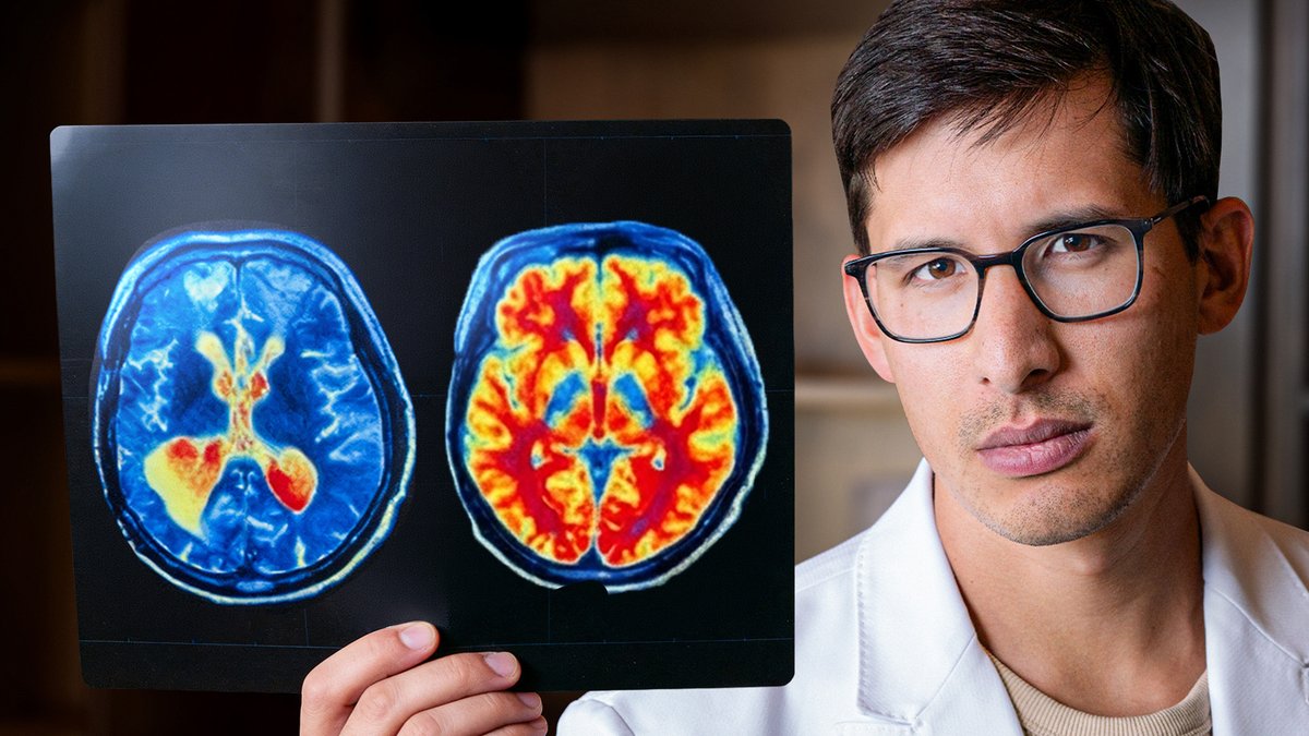 DrJosefWD's tweet image. GLP-1 drugs like Ozempic and Zepbound may cause depression and anxiety in some people.

Yes, I know the FDA says there is no increased risk.

I used to work there. Let me explain what is going on.