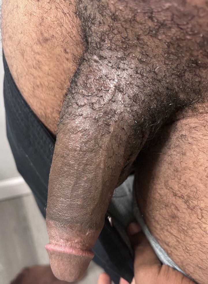 8inchesooflove's tweet photo. kiss it donโt be shy๐ #hung #chudai #bbc #cumgetsome #614freaks #links https://t.co/KYfy21Gh1V
