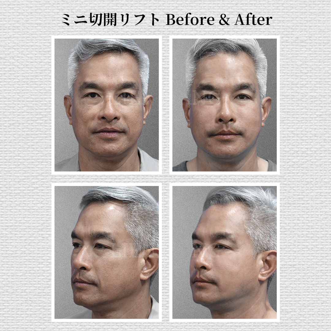 【公式】リエンジャン_LAB tweet media