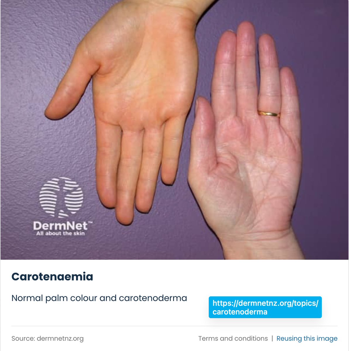 SoS@皮膚科専門医試験対策編 tweet media