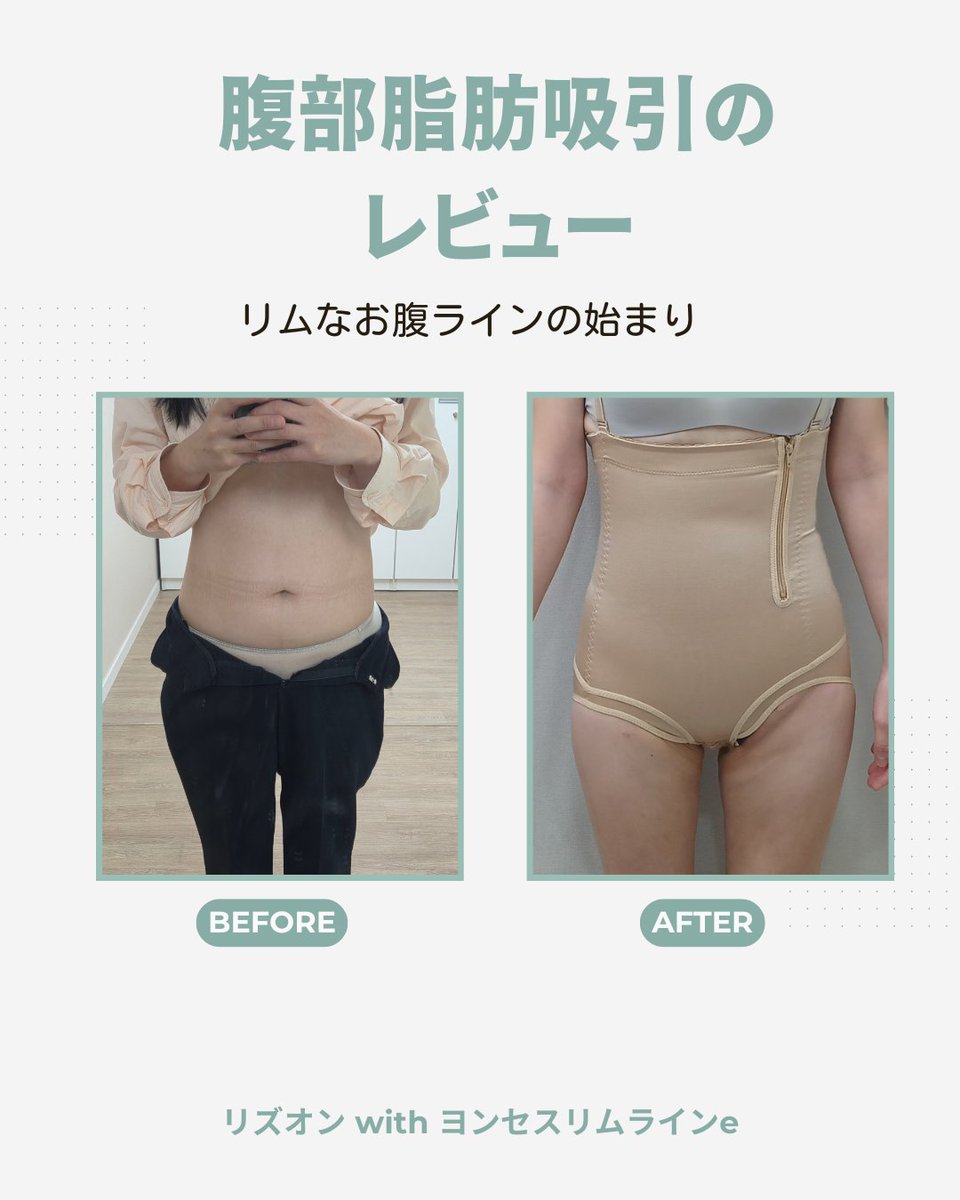 ヨンセスリムライン医院 tweet media