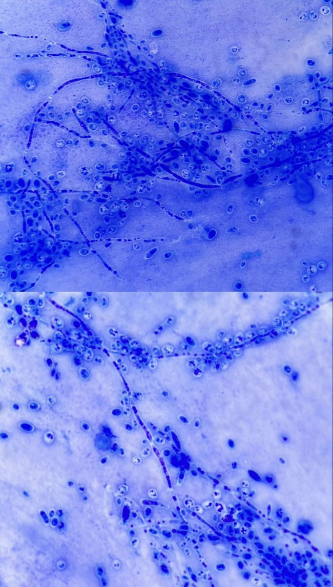 Ini lah saatnya w kenalin profesi w yang ga terkenal itu. Kalau kalian sakit trus periksa darah, urin, swab tenggorokan, dll itu yang periksanya kami🥹🫰🏻. Kami bantu dokter untuk menegakan diagnosis dan menentukan pengobatan pasien —walaupun dibalik layar (jarang terlihat)🥹🥹🥹