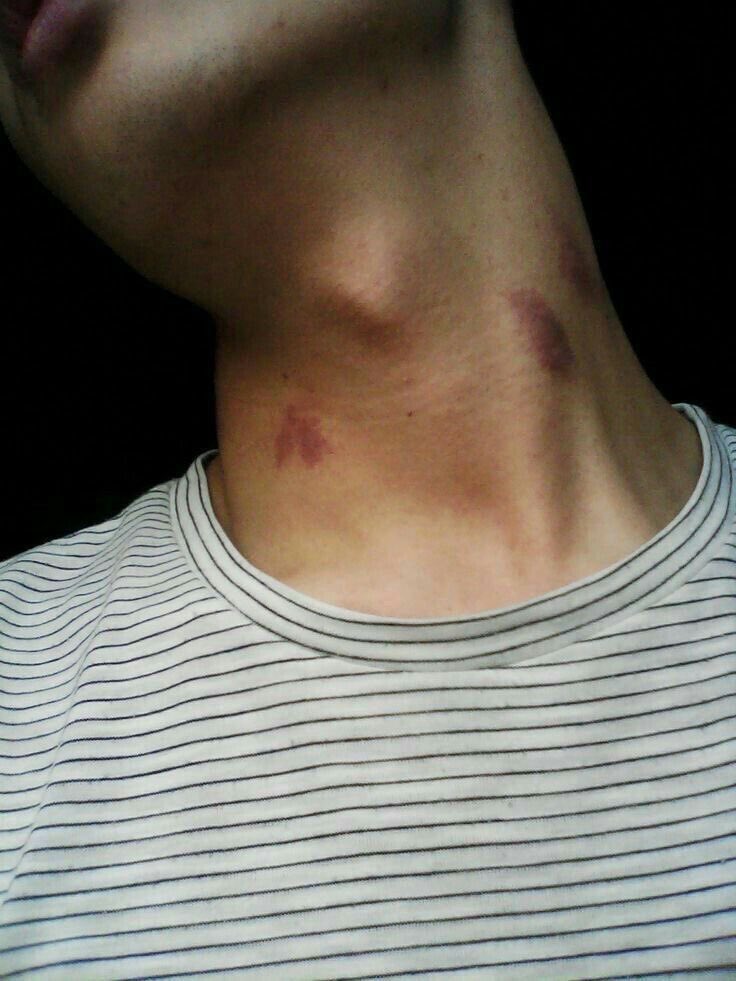 so possessive and obsessed with each other they constantly leave marks