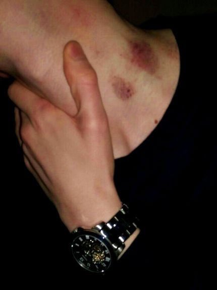 stb3rrysammies's tweet photo. so possessive and obsessed with each other they constantly leave marks https://t.co/Q6H0kCPcjv