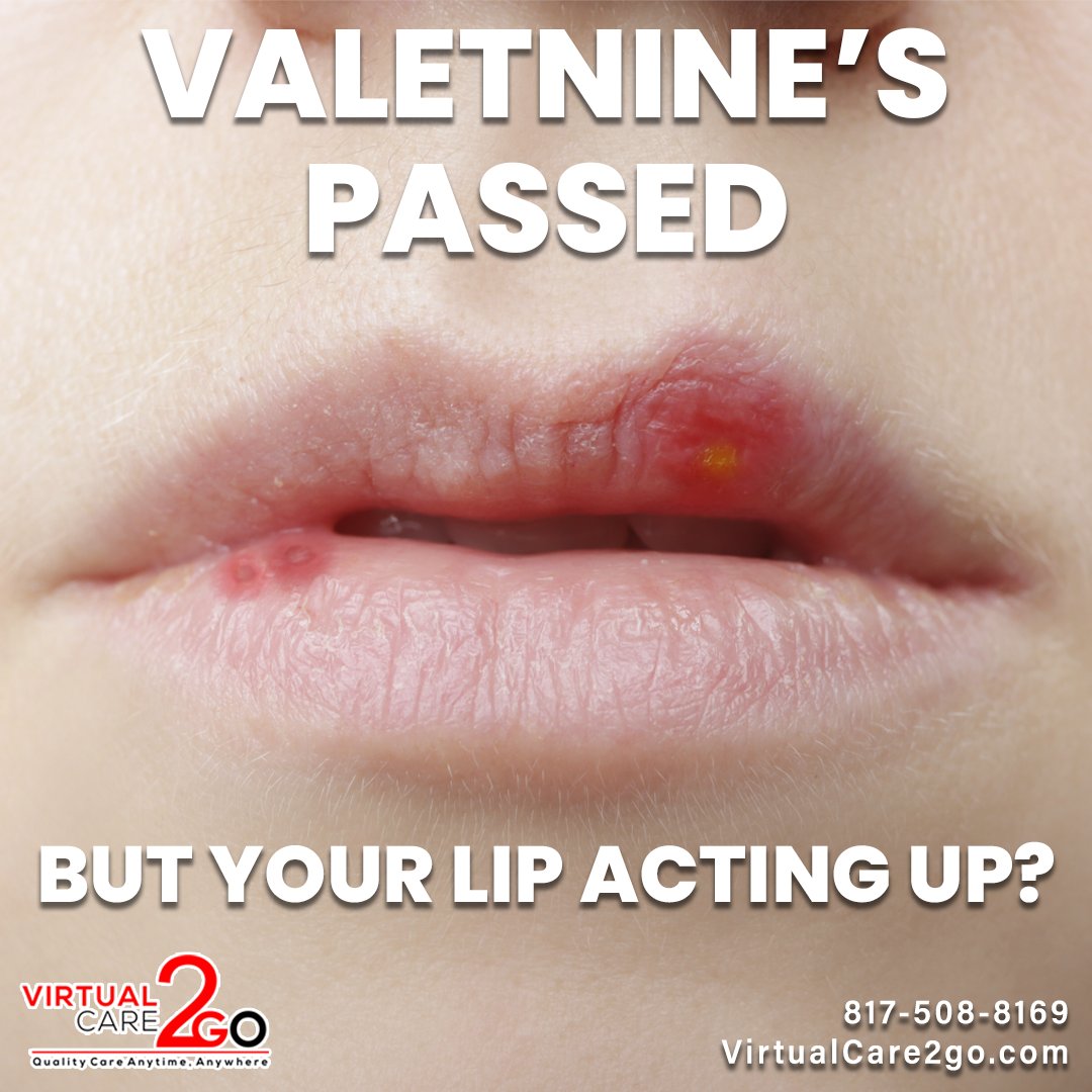 VirtualCare2go's tweet photo. Valentine’s passed… but your lip acting up?

Lip tingling, irritation, or blisters may be signs of a #coldsores (HSV-1). VirtualCare2Go provides convenient telehealth visits with medical evaluation &amp; treatment options to support faster healing.

#HSV1 #Telehealth #VirtualHealth https://t.co/1wnXfO5yAM