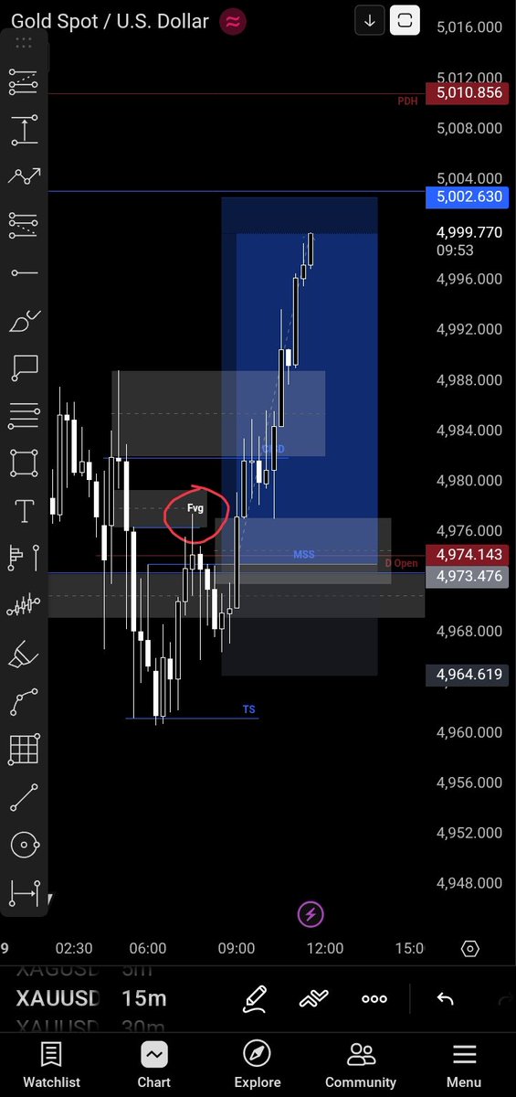NadeepaSadun's tweet photo. Chasing pips with the crew, then back to those dark charts—just us and the market. 💥🔍 #ScalpMode #TradingCrew #ChartGame
@ANDRO9326 @NimeshPrazanka 🫂 https://t.co/hlIarZpHw9