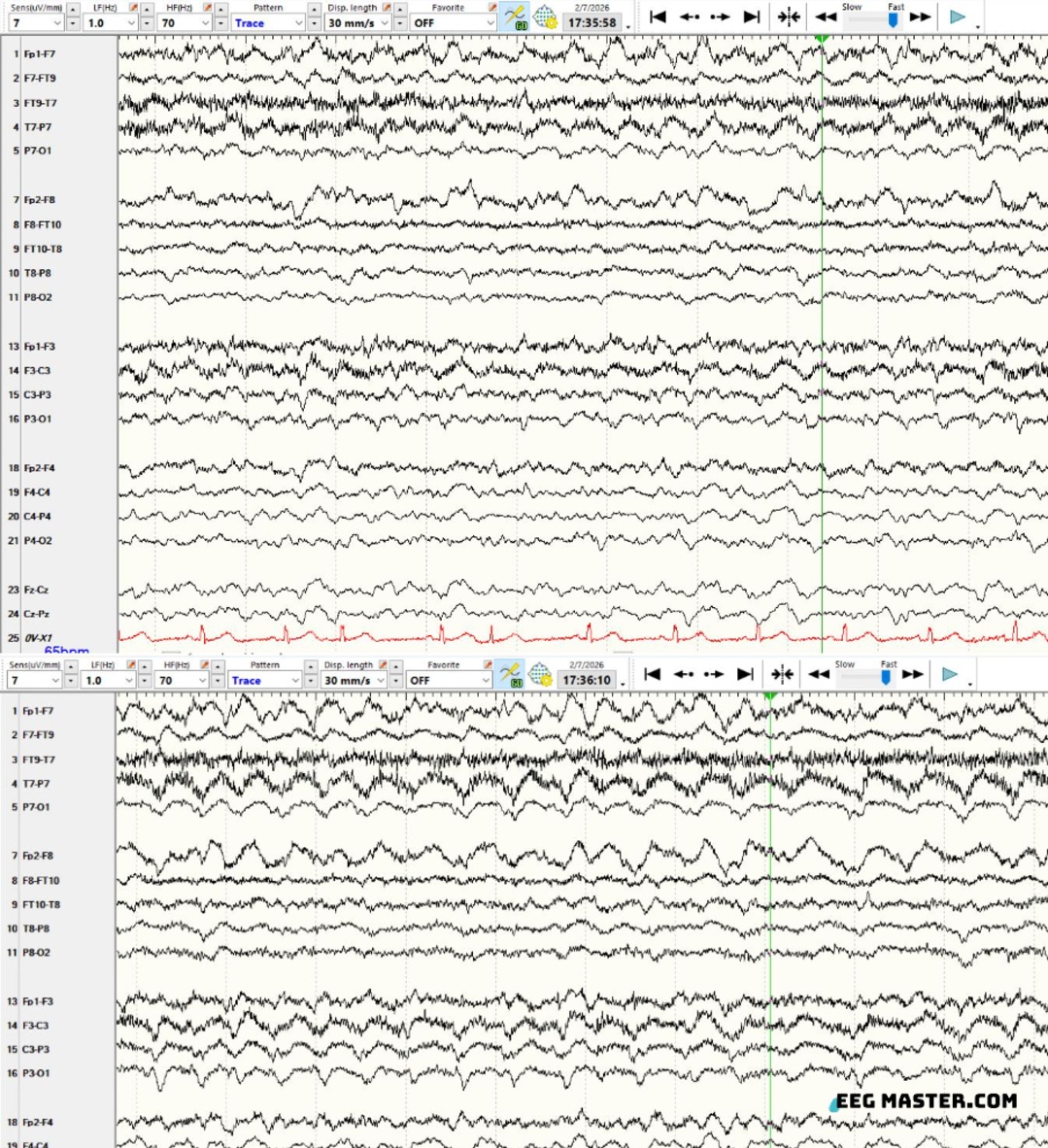 EEG Master tweet media