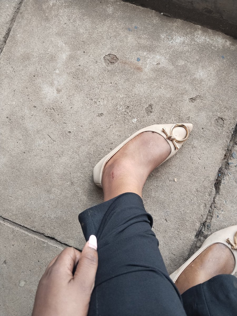 wambuigm's tweet image. I was attacked yesterday outside muthaiga police station around  3pm.The boda boda riders were in a large group riding chaotically on the service lane and some robbing pedestrians😡