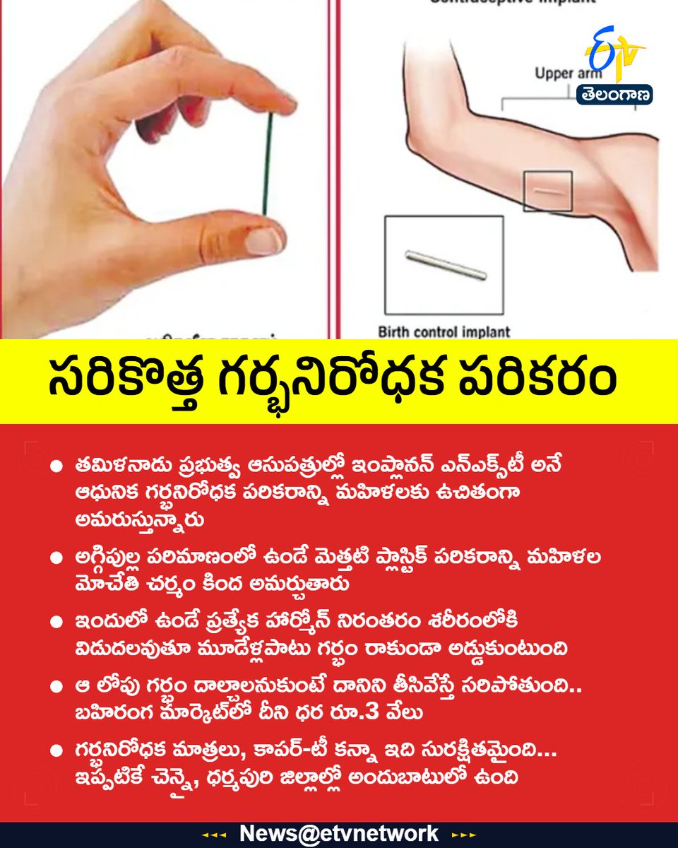 etvtelangana's tweet photo. #Tamilnadu
#pregnancy
#Birthcontrolimplant
#etvtgbreaking https://t.co/b1f0k9d4qY