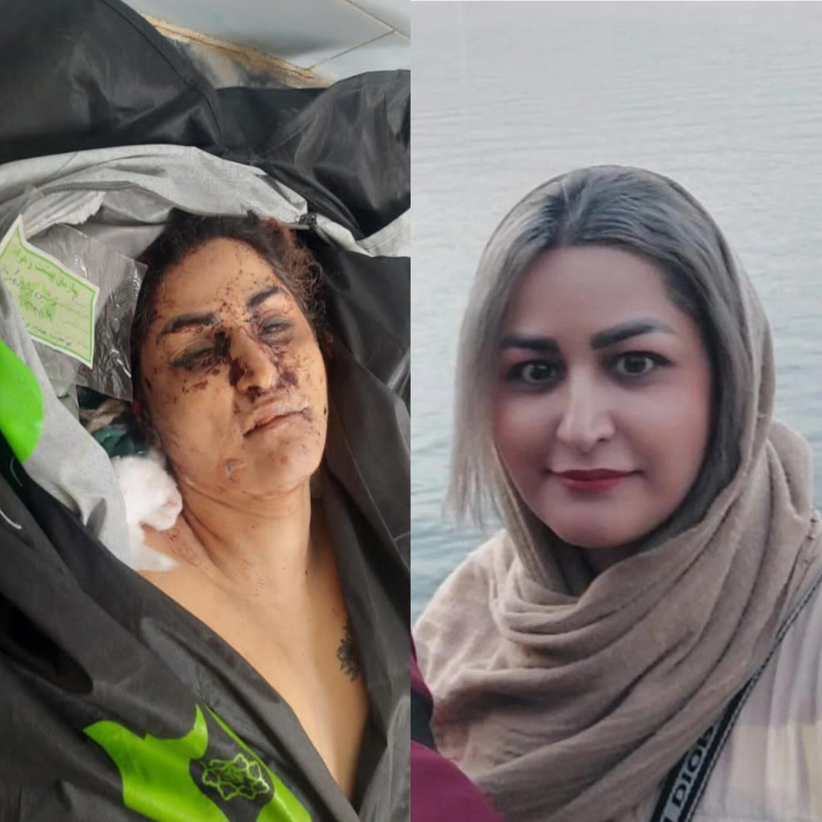 Her name is Noushin Baradaran Kermani. She was shot and killed by the security forces of #Iran’s Islamic regime for participating in the anti-regime protests on Khosh Street of #Tehran on January 8, 2026. She was first wounded, and then executed in the street by the regime’s