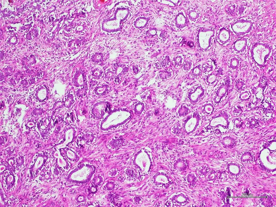 aung phyo tweet media