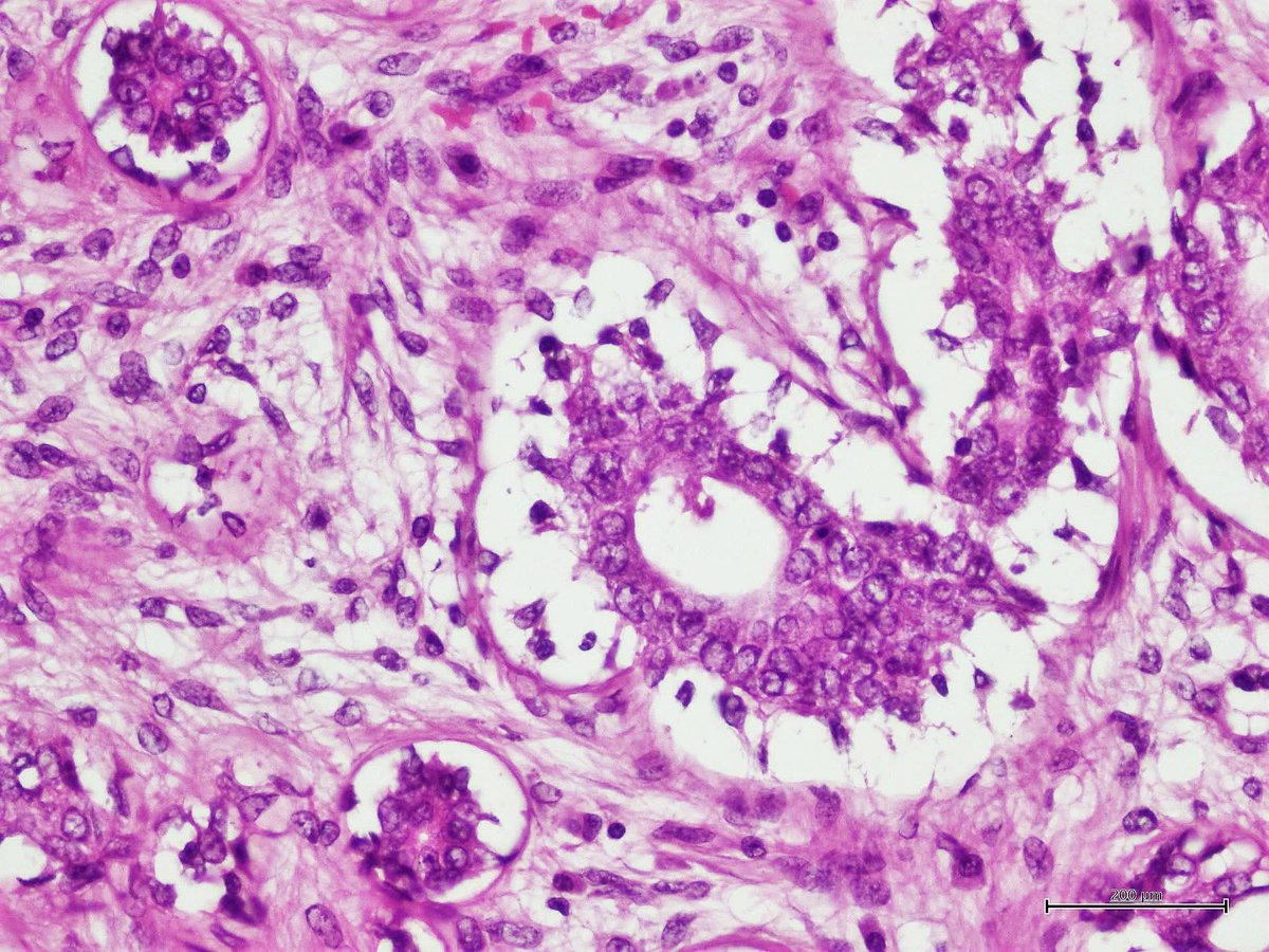 aung phyo tweet media