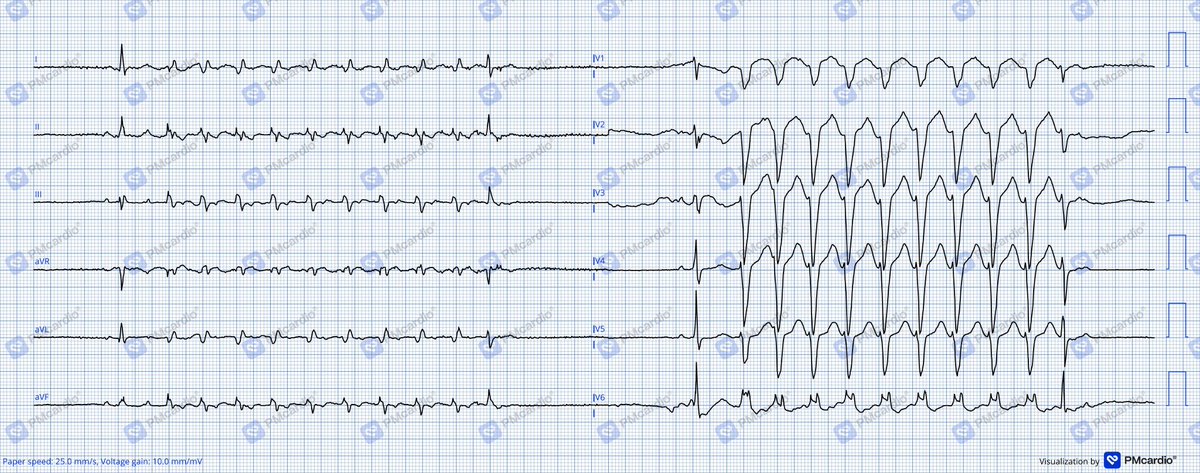 Kaspar L. tweet media