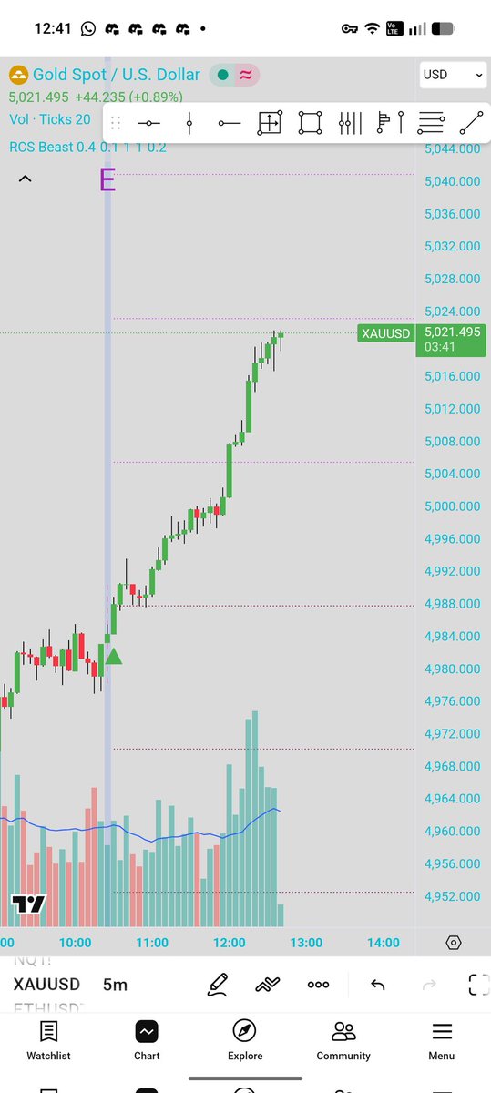 sagetrader_'s tweet photo. #xauusd #gold signal by the indicator https://t.co/2DeTDkyQOv