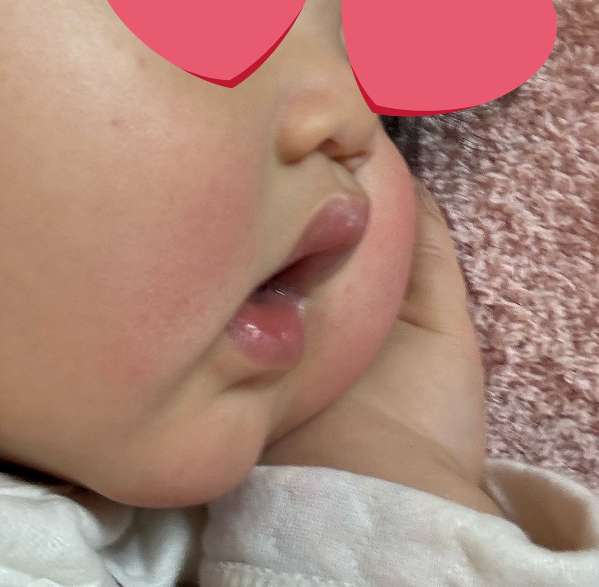 berrie0519's tweet photo. 行き場を失って押しつぶされてる頬とそれにより鼻呼吸なのに口が開いてしまうの尊い🥰 https://t.co/40D5spfO7E