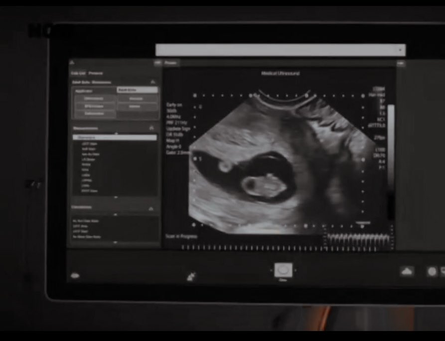 her fav güneşsuya elveda..🌞👋🏻