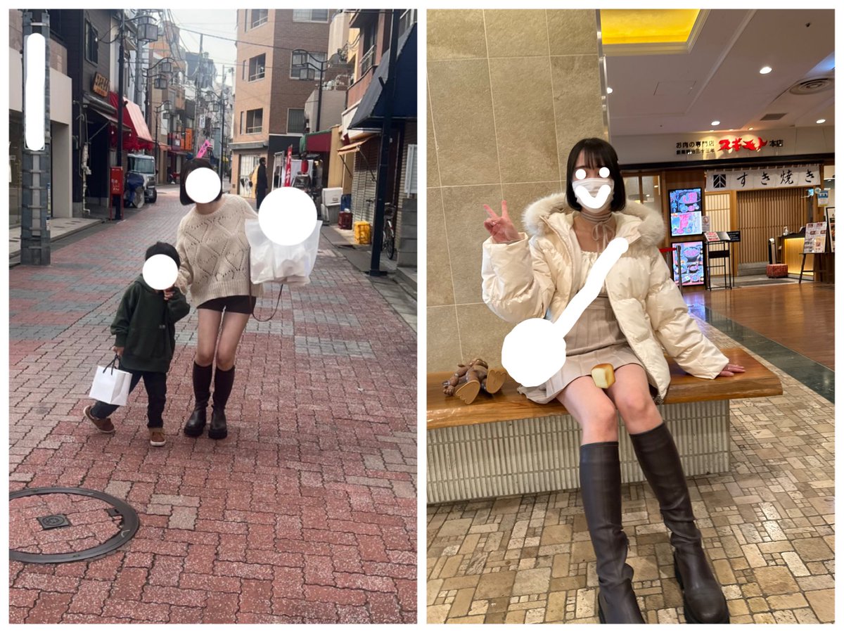 _sayaaarin's tweet photo. 韓国のディライト医院にて
太ももの脂肪吸引と脂肪豊胸をし3ヶ月経ちました。
ボコ付きもなくまっすぐになり、傷跡も全然目立たなくて大満足です。
コンプレックスだったのでビフォーの写真が全然なかったのですが😣
今ではたくさん足出してますありがとうございました♡
@delight_ps_jp https://t.co/f5sqvi3ZKO