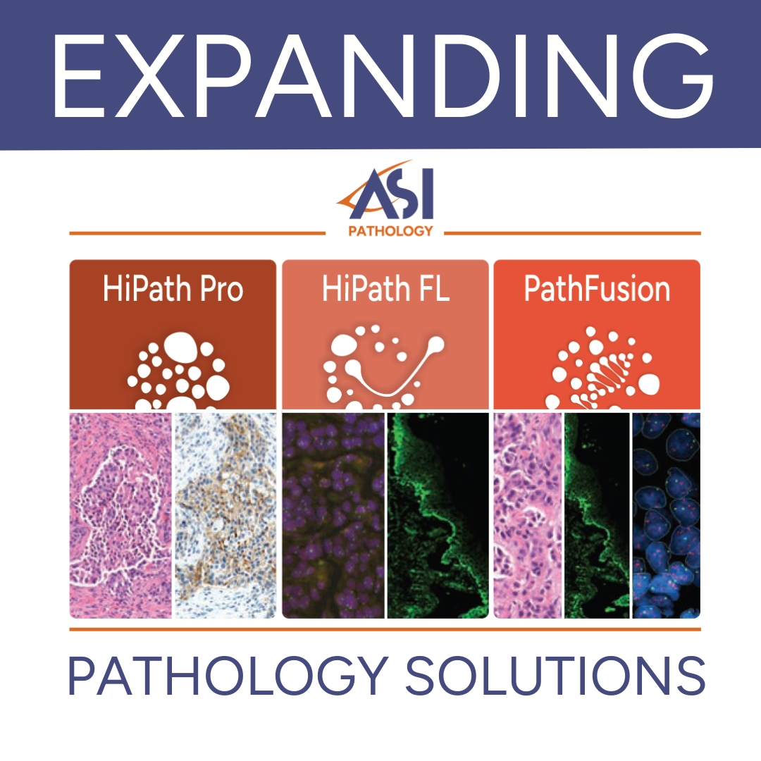 Introducing HiPath FL-expanding ASI’s digital pathology portfolio into whole slide fluorescence imaging. Scan, review, and preserve FISH &amp; IF slides as digital WSI, compare multiple fluorescent specimens side-by-side, and support collaborative tissue diagnostics.
#FISH #WSI #ASI