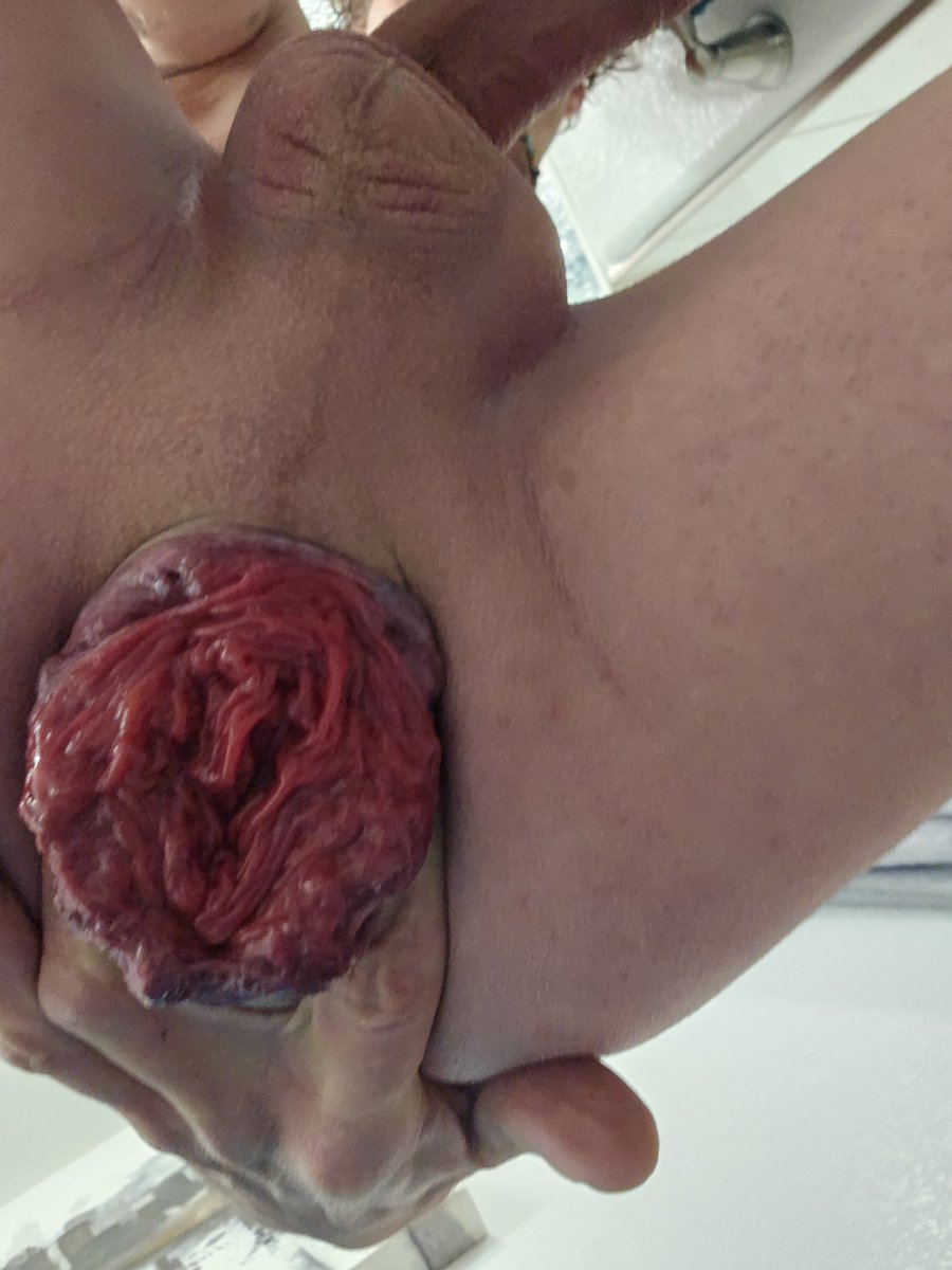 BiColorado tweet media