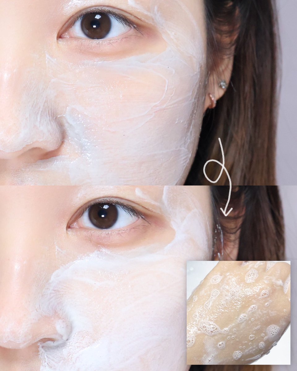 #광고 <a href="/brmud_official/">비알머드 BRMUD</a> 
팩처럼 사용 후, 물을 더하면 폼으로 전환...•💧
ㄴ 비알머드 팩투폼 클렌저 ☁️

팩과 폼의 두 가지 기능을 하나에 담은 팩투폼 클렌저! 팩 상태에서도 엄청 부드럽게 발리고, 세안후에 피부 당김 Xxx 촉촉하고 편안해요🤤☁️🤍

>초미세 보령 머드 파우더< 노폐물 흡착 / 피부