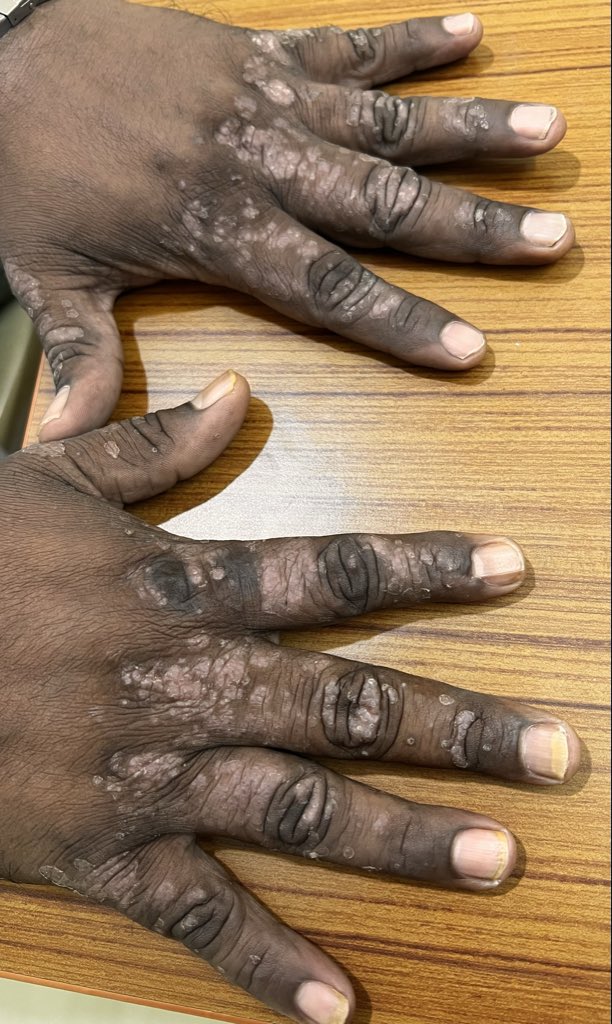 ILLIASUL IBAD tweet media