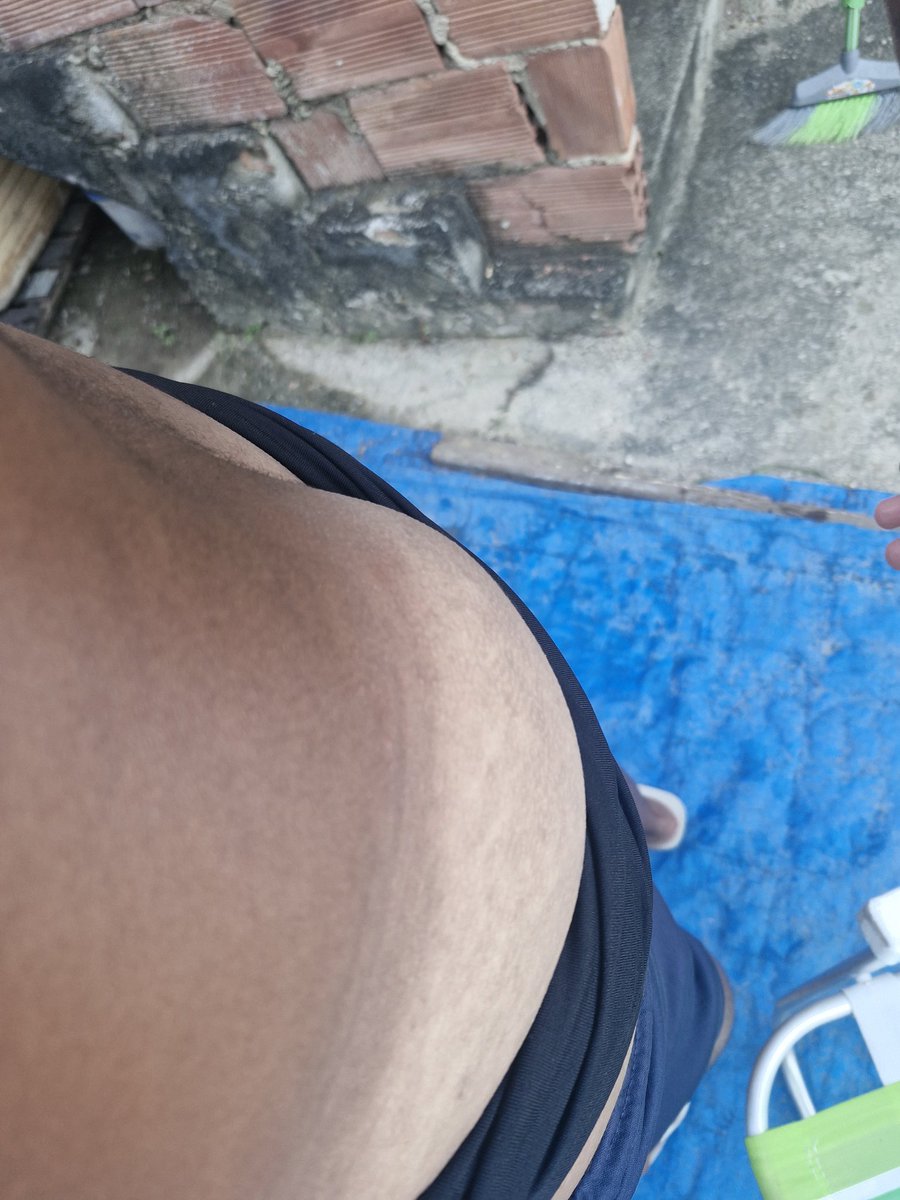 Magrinhoo69's tweet photo. Queimadinho do verão 🌞🏖 https://t.co/cDGscIpSl9