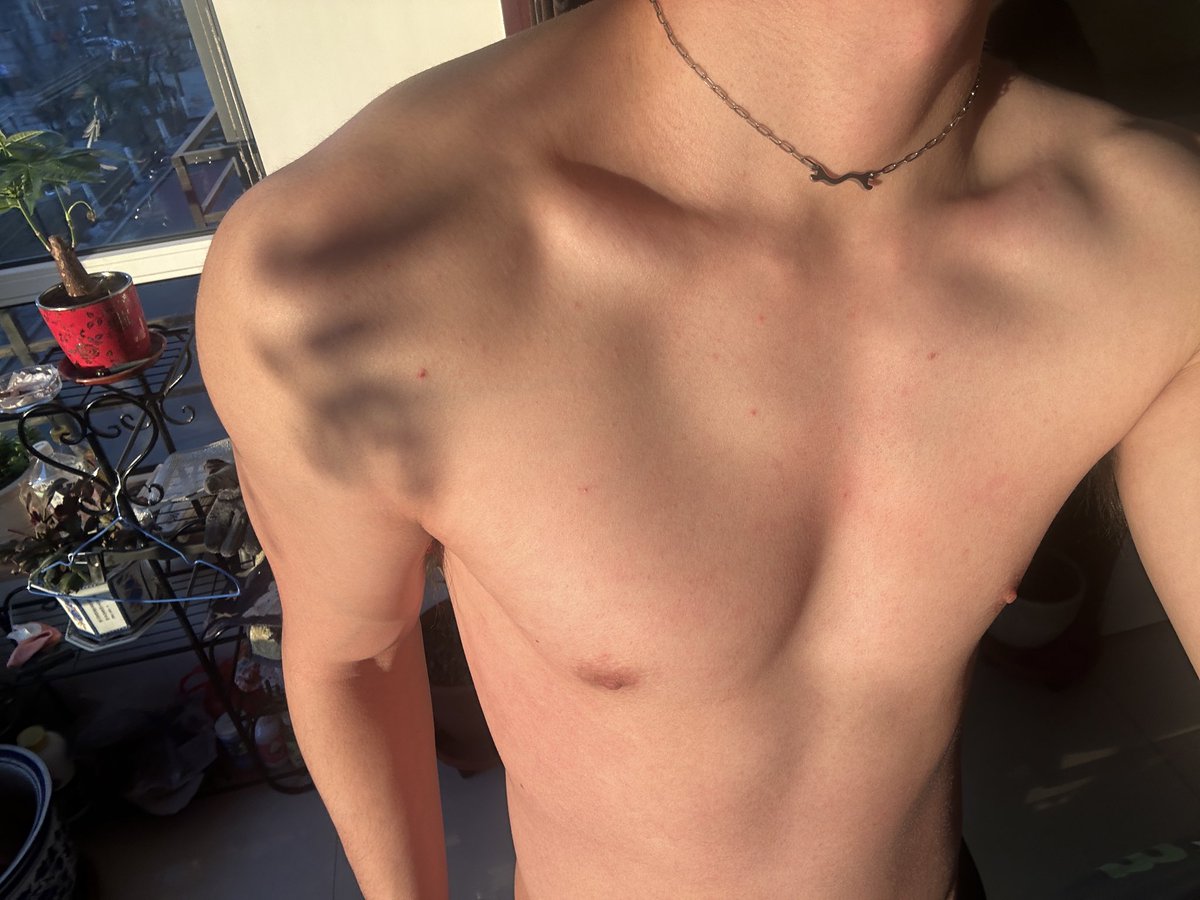 陌生的暖气