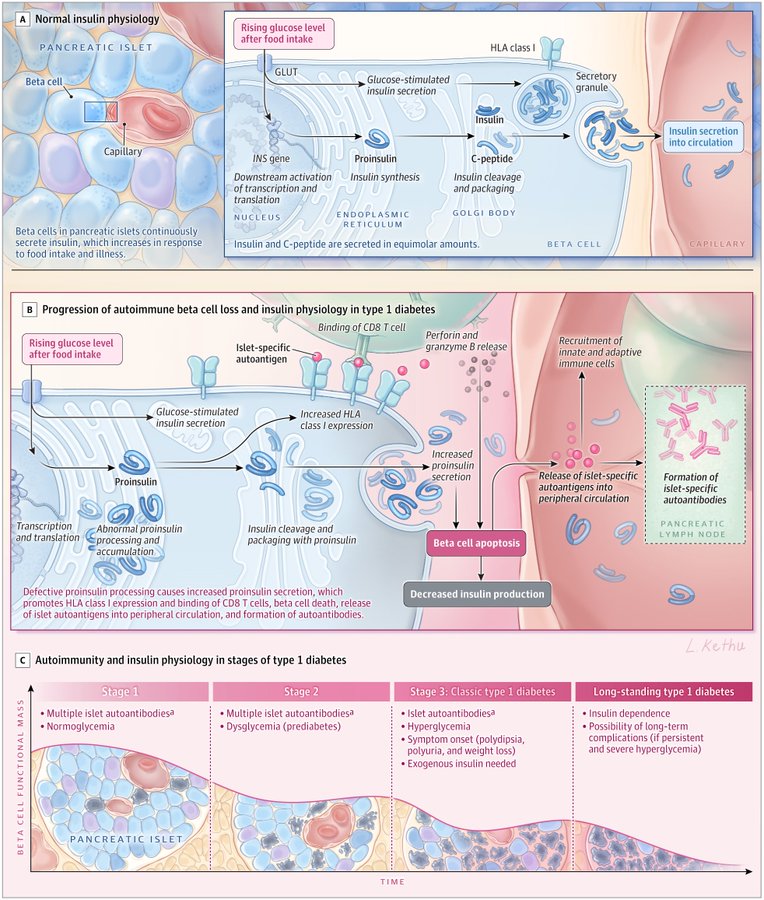 mac_anas's tweet image. Diabetes tipo 1. 
Revisión

 | JAMA

fundacionfemeba.org.ar/blog/farmacolo…