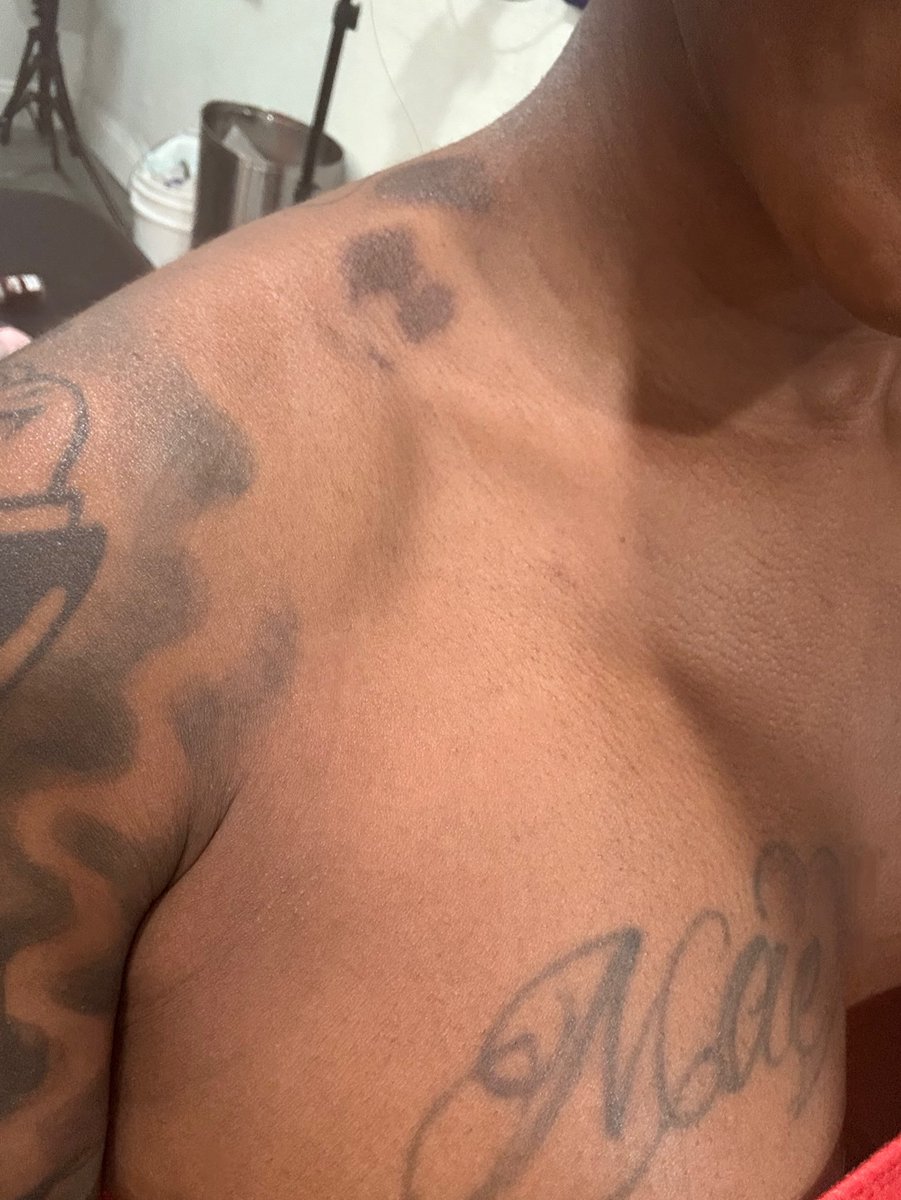 My tat inspo I wanted to cover my burn on my shoulder &amp; how it came out. 😍😍😍🔥>>