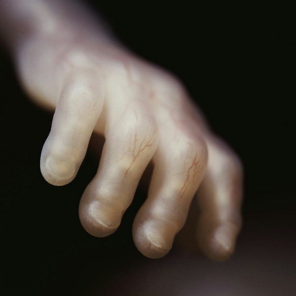 sola_chad's tweet image. The hand of a child in the womb at 17 weeks. Not a “clump of cells” but instead, “fearfully and wonderfully made.”

Abortion is murder and must be abolished.