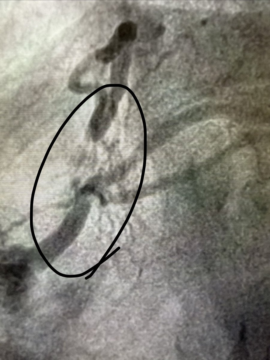 Aditya Mandawat, MD tweet media