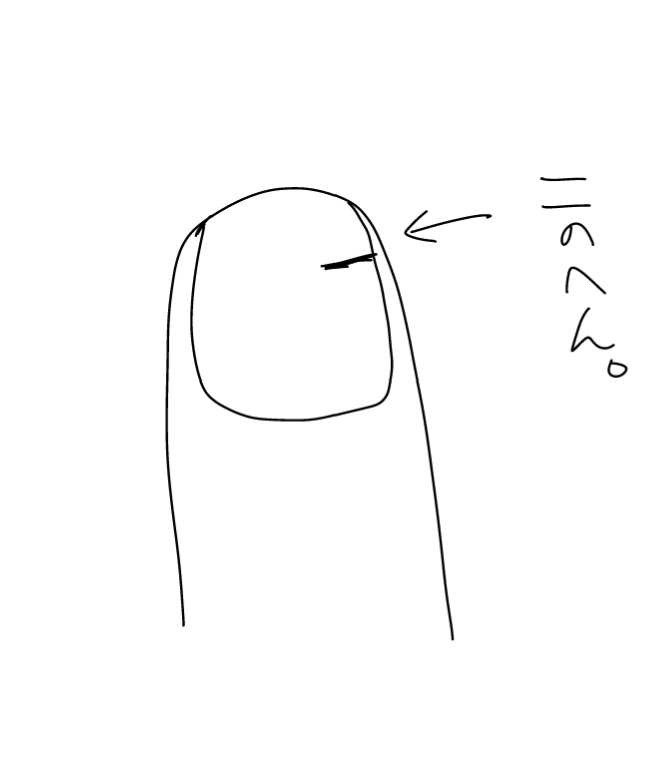 手の親指の爪の同じ場所が定期的に割れるんですが、同じように割れるよ!って皆様、なにか対策とかしてます…?割れた後どうしてますか…?同じ指だけ割れるので…。 