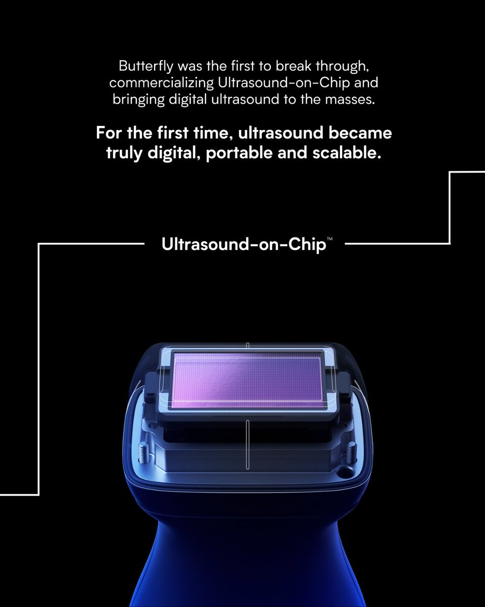 Butterfly Network tweet media