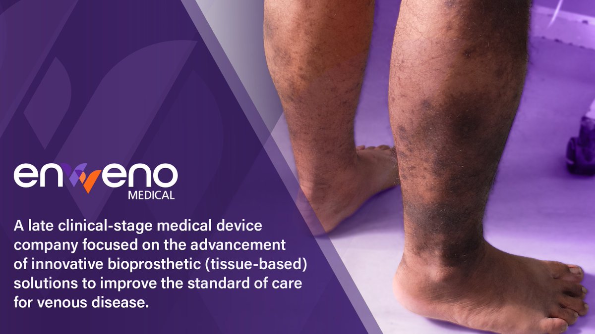 enVVenoMedical's tweet image. We are a late clinical-stage medical device company focused on the advancement of innovative bioprosthetic (tissue-based) solutions to improve the standard of care for the treatment of venous disease

$NVNO #CVI #VenousDisease
