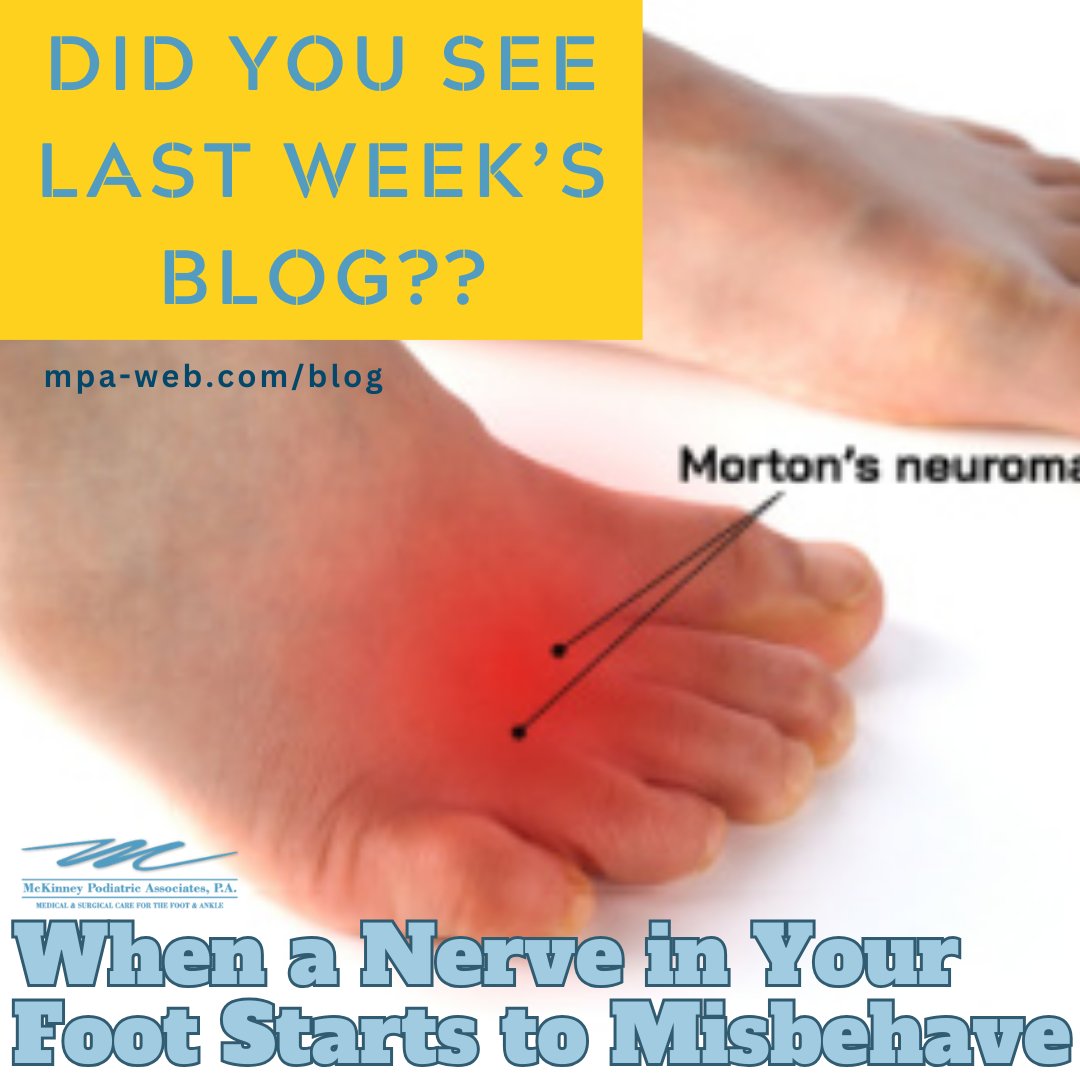 Morton's neuroma is a painful foot condition that commonly affects the areas between the 2nd and 3rd or 3rd and 4th toe, although other areas of the foot are also susceptible. It's caused by an inflamed nerve in the foot that is being squeezed and aggravated by surrounding bones.