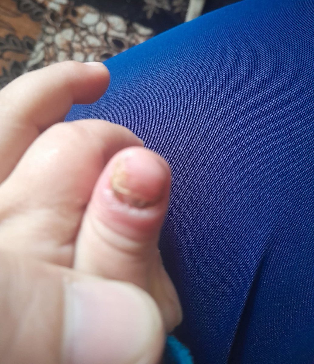 🍉*Fadi - Gaza Aid Request🍉 tweet media