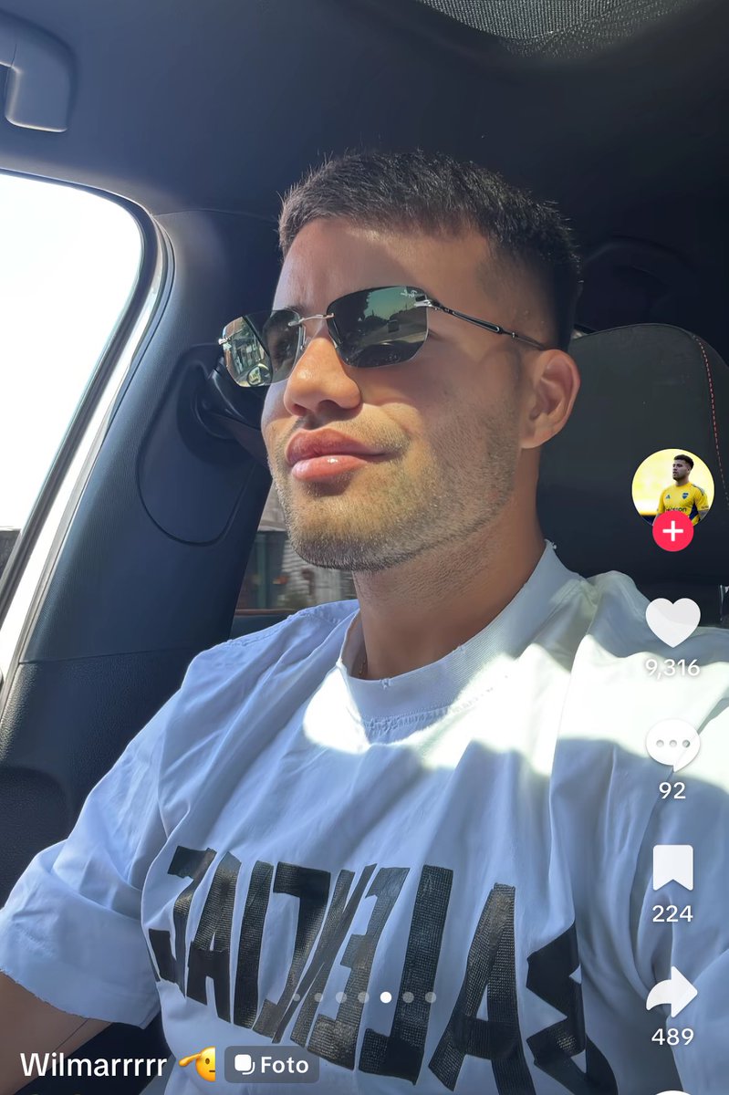 AnguitaMalena's tweet image. El chelo weigandt se hizo los LABIOS